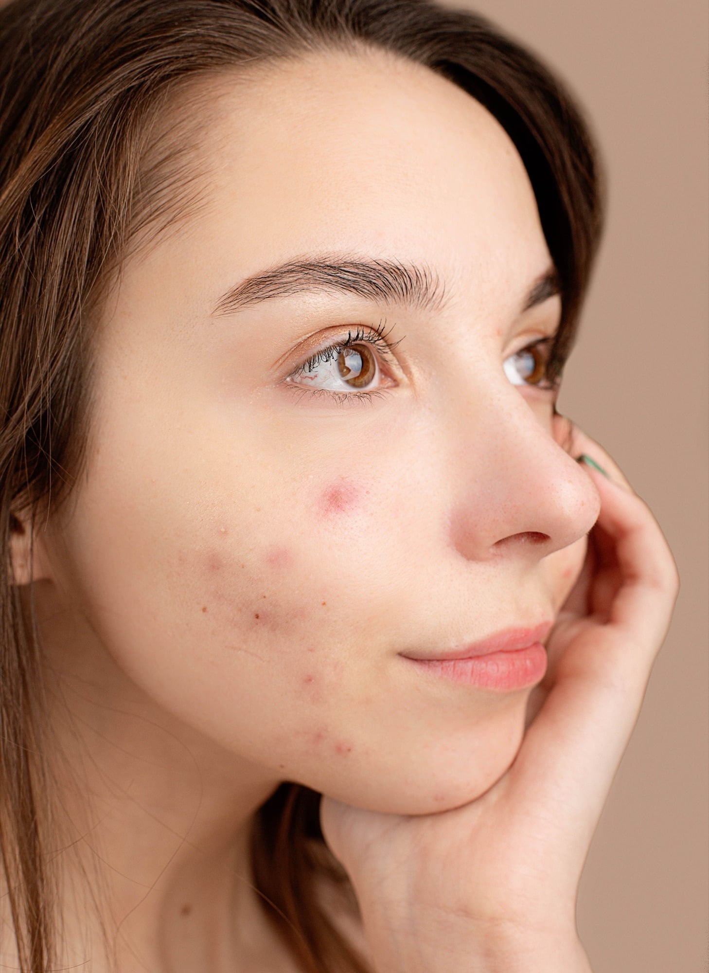 Jeune femme, la main sur la joue, avec des boutons