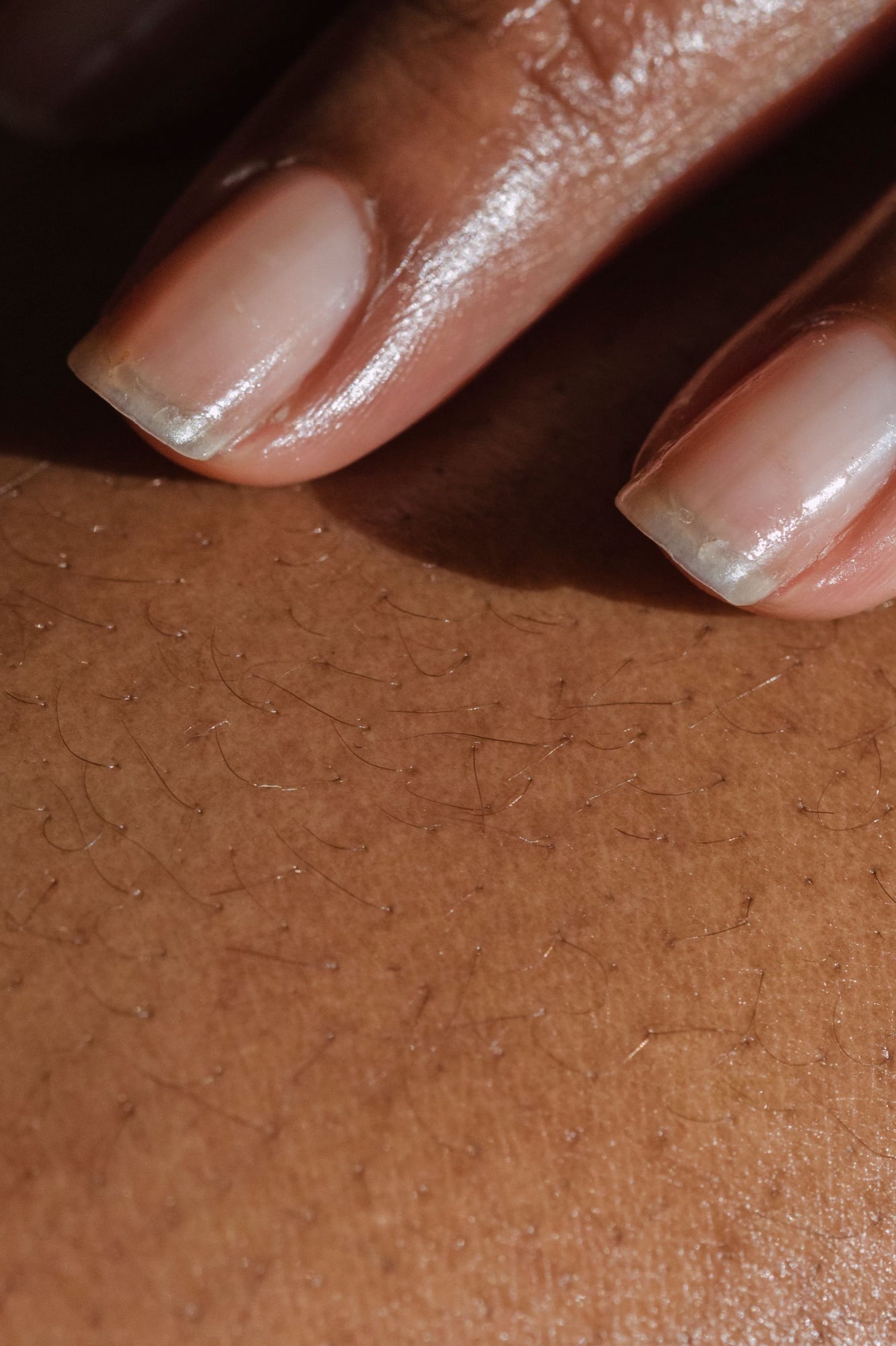 Peau foncée en gros plan, avec texture et poils